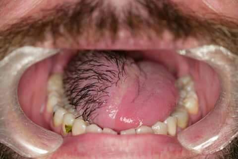 الشعر في اللسان في المنام