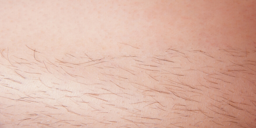 الشعر في جسم المراة في المنام