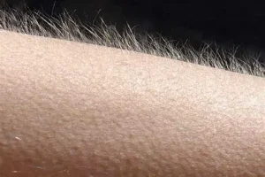 الشعر في اليد في المنام