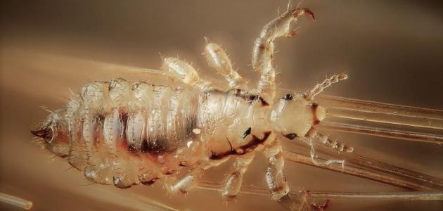 القمله البيضاء في الحلم